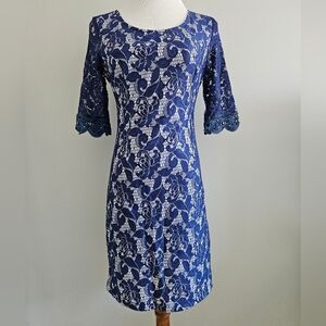 Elegant Blue Lace Dress